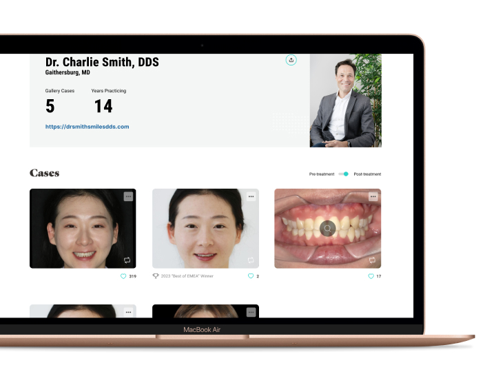 Align Global Gallery dentist page demo on laptop